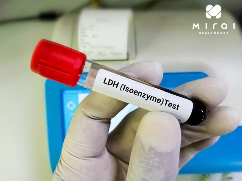 y-nghia-chi-so-ldh-trong-xet-nghiem-mau