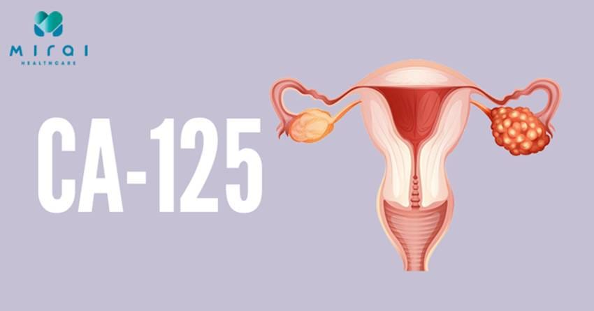 y-nghia-cua-xet-nghiem-ca-125