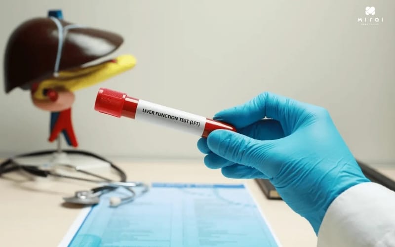 y-nghia-cua-xet-nghiem-dcp