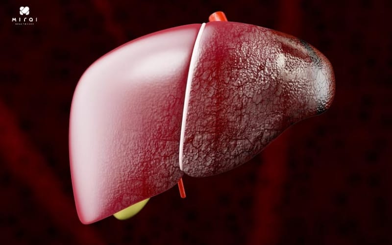 Chỉ số creatinin thấp cũng có thể cảnh báo vấn đề của gan