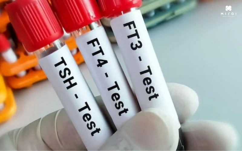 Xét nghiệm Anti Tg thường được làm cùng với TSH, FT3, FT4