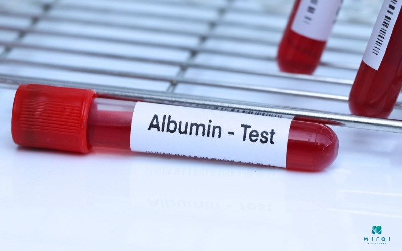 Chỉ số Albumin có thể bị ảnh hưởng bởi nhiều yếu tố