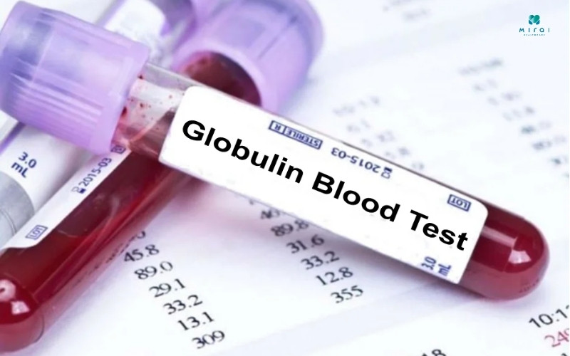 Định lượng protein là đo lượng globulin và albumin trong máu