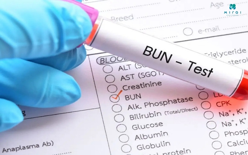 Định lượng BUN bình thường là từ 7 - 20 mg/dL