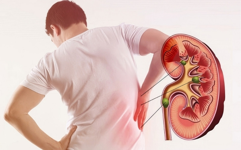 Lượng ure trong máu cao cảnh báo bệnh lý thận
