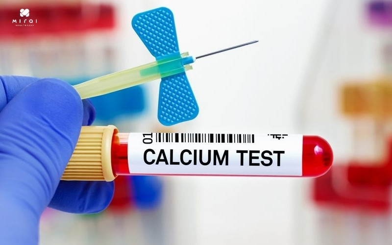 Xét nghiệm Calci máu giúp phát hiện mất cân bằng Calci