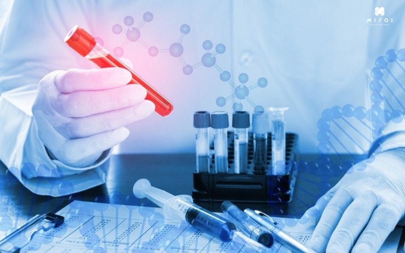 Xét nghiệm Calci ion hóa khi nghi ngờ mất cân bằng Calci