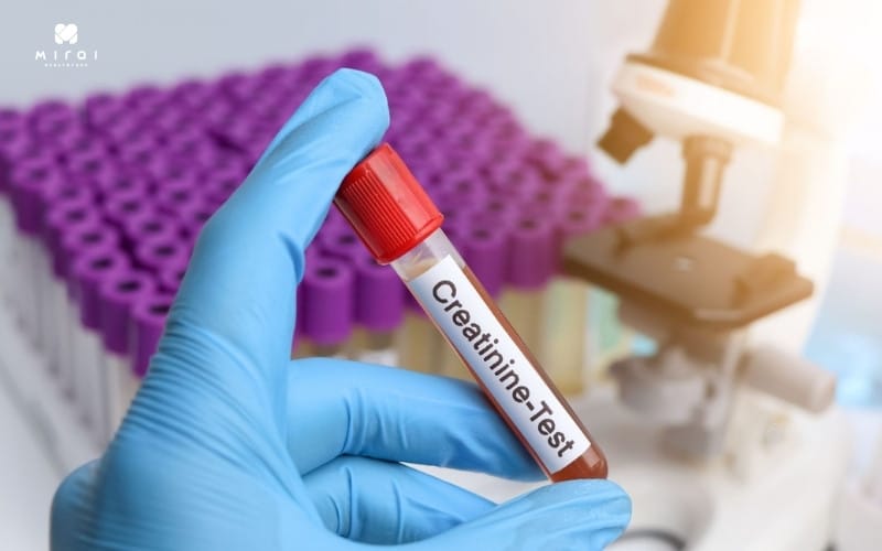 Chỉ số Creatinin giúp đánh giá khả năng lọc của thận