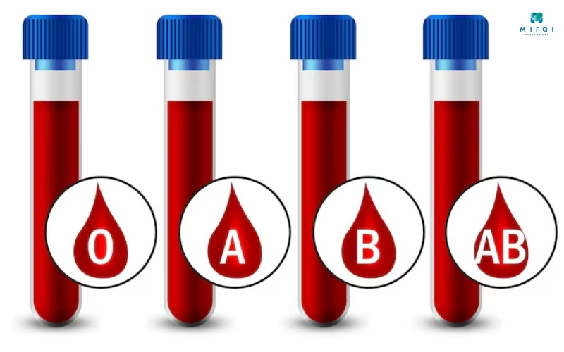 Xét nghiệm nhóm máu thường được thực hiện trước khi truyền máu