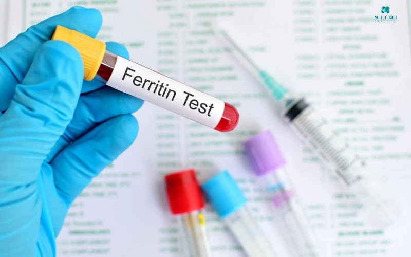 Xét nghiệm Ferritin đánh giá tình trạng thiếu sắt trong máu