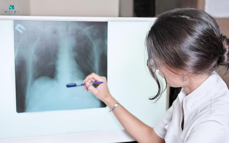 Xét nghiệm hình ảnh giúp phát hiện bất thường ở phổi