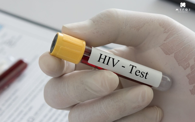 Xét nghiệm máu tìm kháng thể HIV giúp chẩn đoán bệnh chính xác