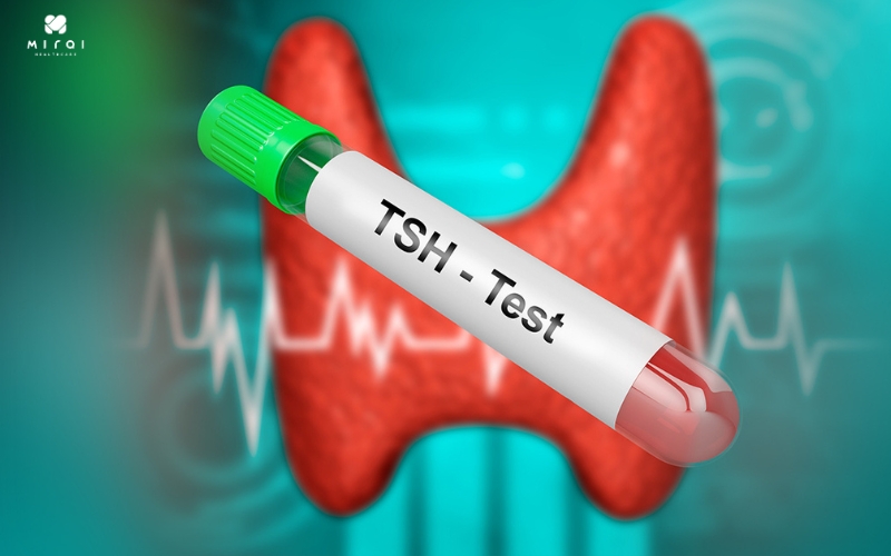 Xét nghiệm máu giúp giúp xác định bất thường tuyến giáp