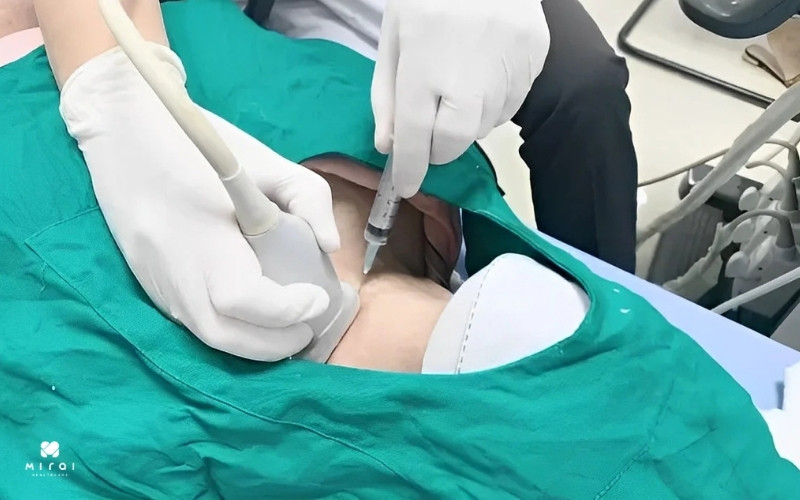 Sinh thiết là biện pháp “vàng” để chẩn đoán ung thư tuyến giáp