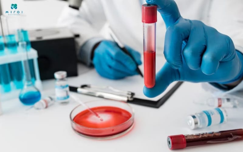 Chỉ số Hb đo nồng độ Hemoglobin - protein có trong hồng cầu