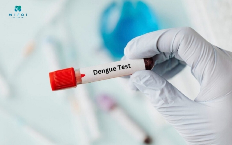 Xét nghiệm Dengue NS1 chẩn đoán sốt xuất huyết sớm 