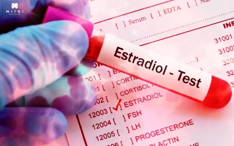 Xét nghiệm estradiol giúp xác định nguyên nhân vô sinh ở nam