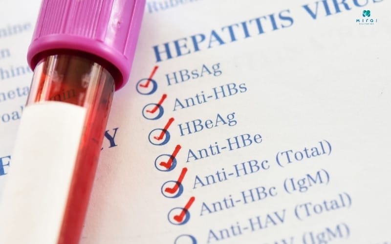 Chỉ số HBsAg dương tính cho thấy bạn nhiễm viêm gan B