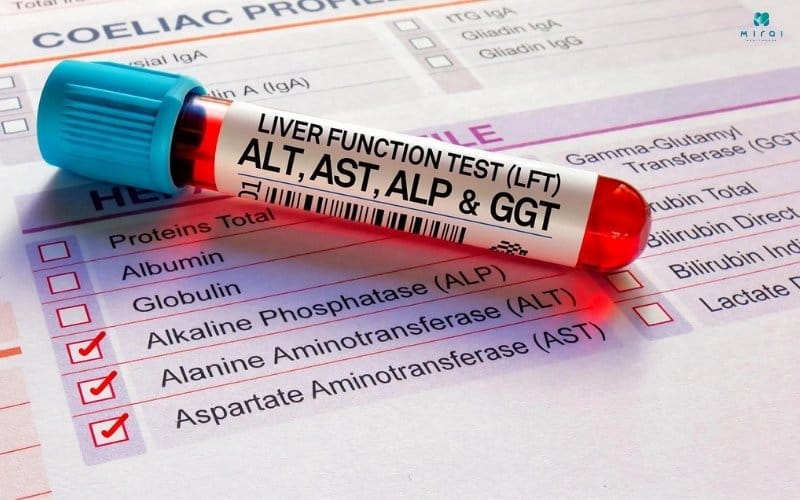 Các chỉ số ALT, AST,... trong máu giúp đánh giá chức năng gan