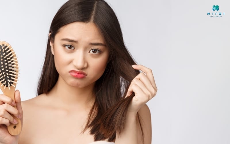 Xét nghiệm Testosterone khi có triệu chứng rụng tóc, nhiều mụn