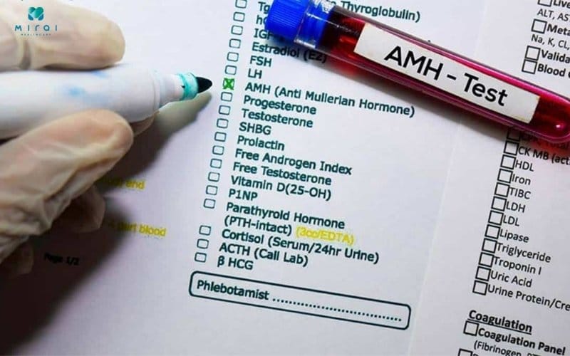 Xét nghiệm AMH giúp đánh giá dự trữ buồng trứng
