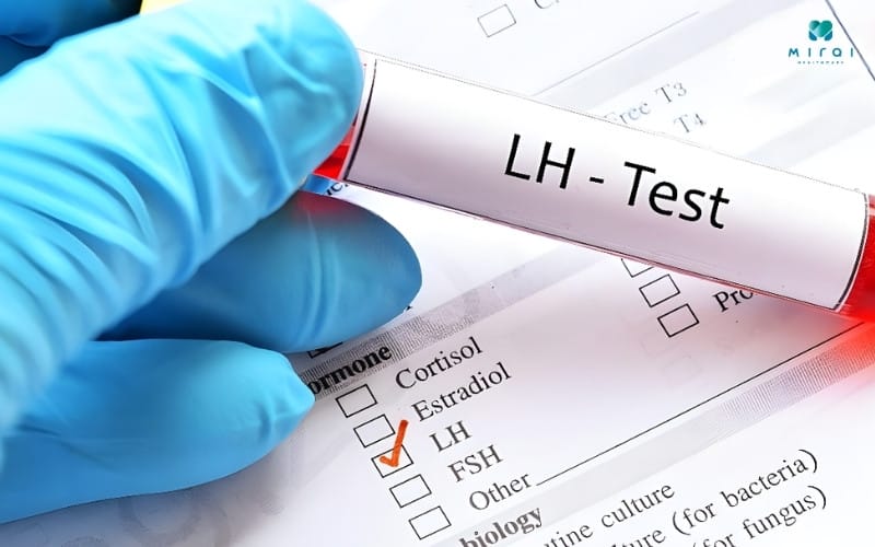 LH được chỉ định xét nghiệm khi kiểm tra vô sinh