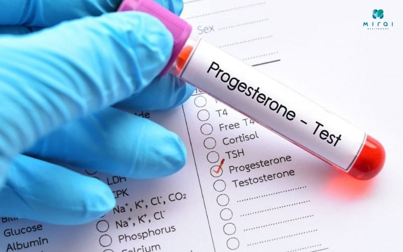 Xét nghiệm Progesterone giúp đánh giá khả năng mang thai