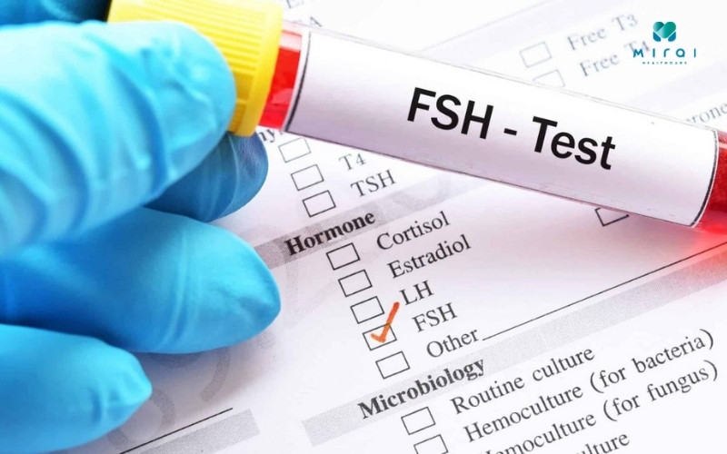 Xét nghiệm FSH để đánh giá tình trạng vô sinh