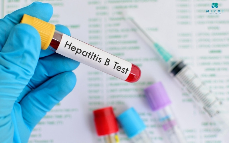 Xét nghiệm virus viêm gan B giúp đo lượng virus trong máu