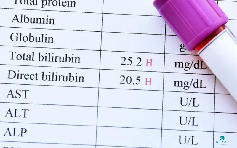 Chỉ số AST, ALT, ALP để đánh giá chức năng gan