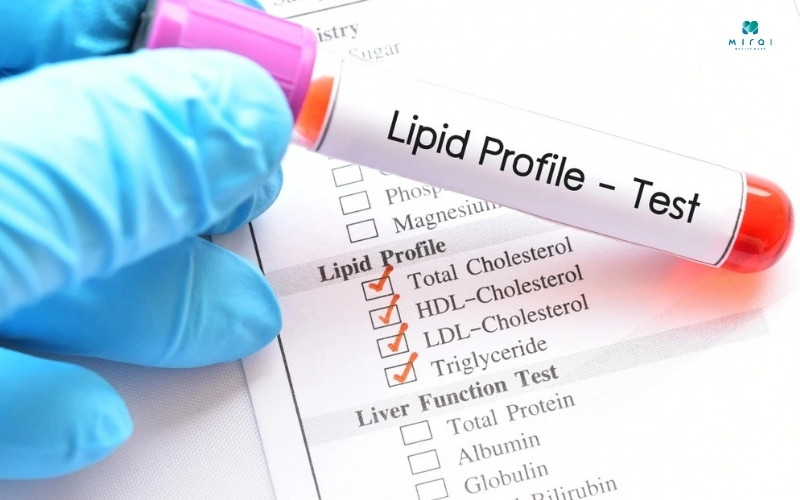Bộ mỡ máu sẽ đánh giá các rối loạn chuyển hóa lipid