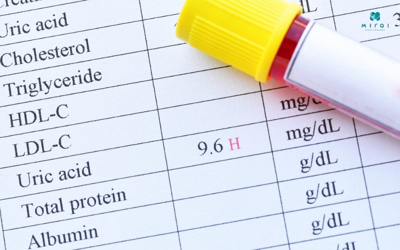 Chỉ số Acid Uric để chẩn đoán và theo dõi bệnh Gout