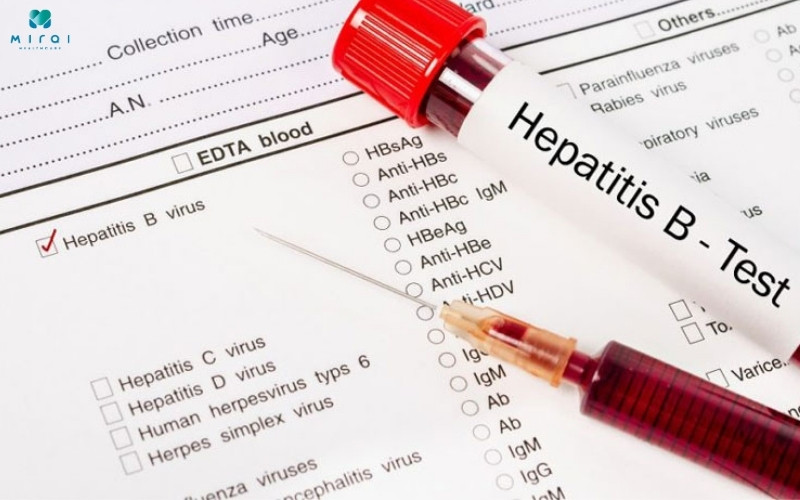 HBeAg âm tính cho biết bạn chưa từng nhiễm virus viêm gan B