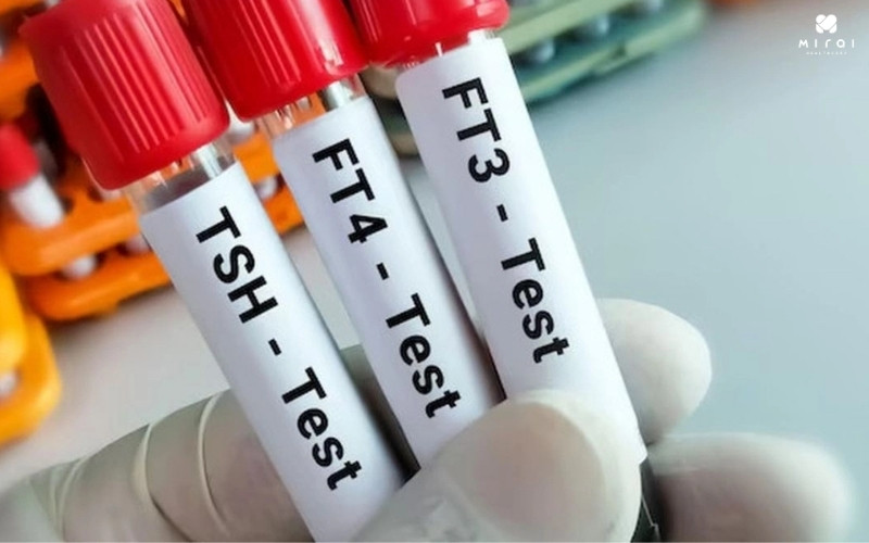 Hormone tuyến giáp cũng có thể ảnh hưởng tới khả năng sinh sản