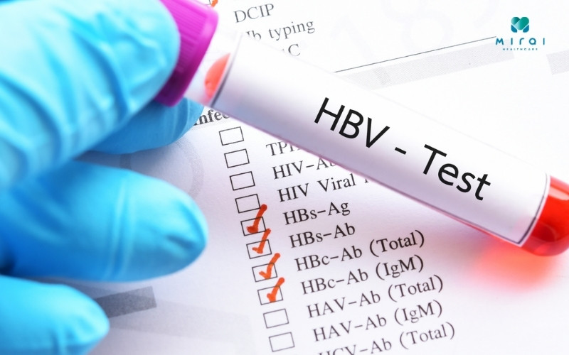 Xét nghiệm HBsAg phát hiện sự hiện diện virus viêm gan B