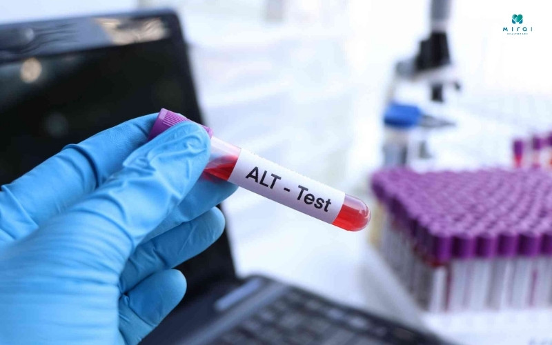 Cần làm thêm xét nghiệm ALT, AST để đánh giá tổn thương gan