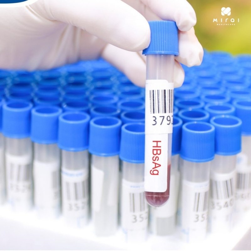 Xét nghiệm HBsAg an tâm tại Mirai Healthcare 