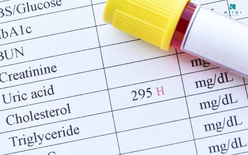 Cholesterol toàn phần là đo tổng lượng cholesterol trong máu