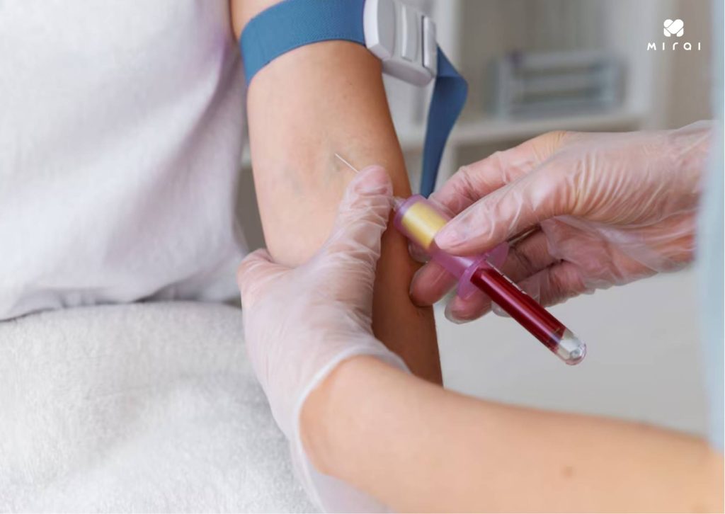 Chi phí xét nghiệm mỡ máu phụ thuộc vào cơ sở y tế bạn chọn