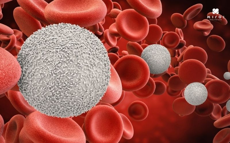 Xét nghiệm WBC để đo lượng bạch cầu trong cơ thể