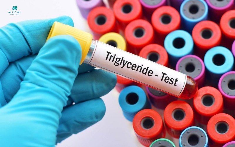 Nồng độ triglyceride cao làm tăng nguy cơ mắc bệnh tim mạch