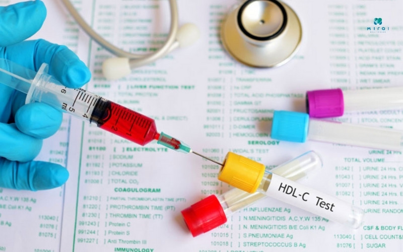 Mức HDL cao, giảm thiểu nguy cơ mắc bệnh tim mạch