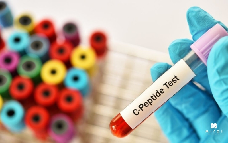 Xét nghiệm C-Peptid giúp theo dõi đường huyết