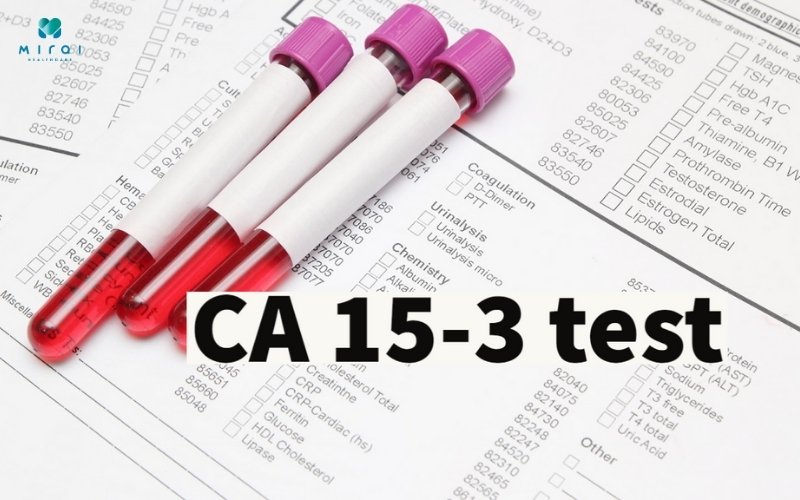 Chỉ số CA 15 - 3 cảnh báo bệnh ung thư vú tái phát