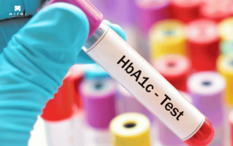 Chỉ số HbA1c bình thường là <5.7%