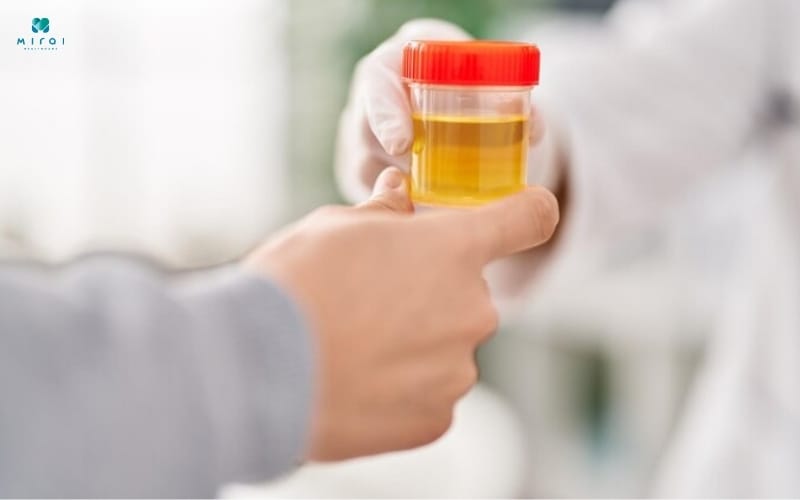 Làm xét nghiệm creatinin niệu khi cần đánh giá chức năng thận