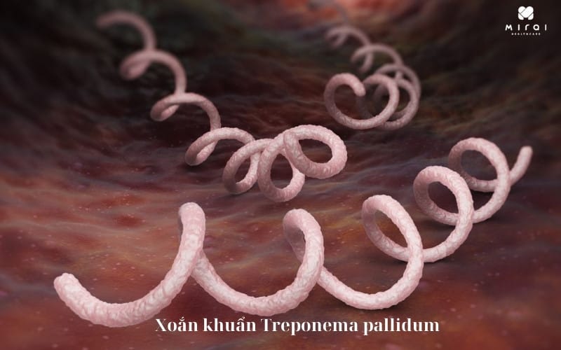 Xoắn khuẩn Treponema pallidum nhân tố chính gây bệnh giang mai