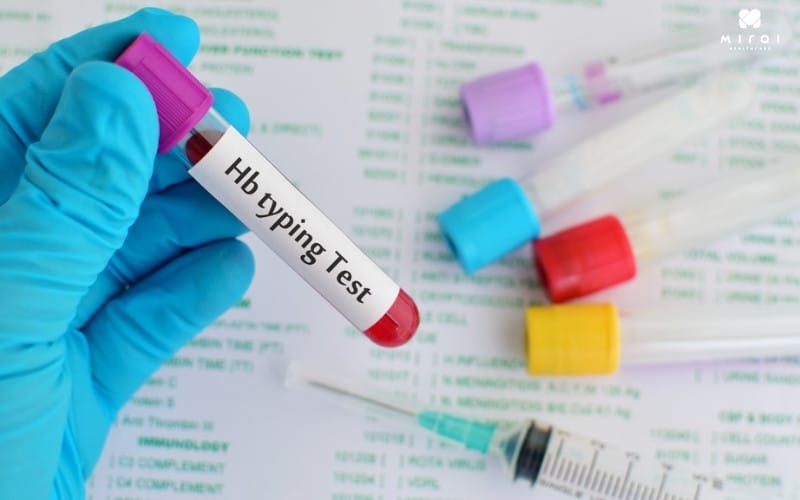 Chỉ số HB giúp chẩn đoán thiếu máu