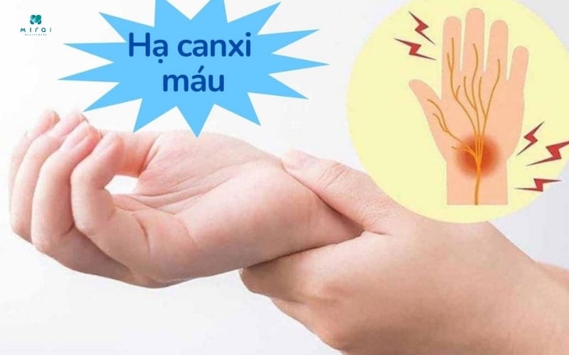 Hạ canxi máu gây ra các triệu chứng co thắt cơ, co giật,...