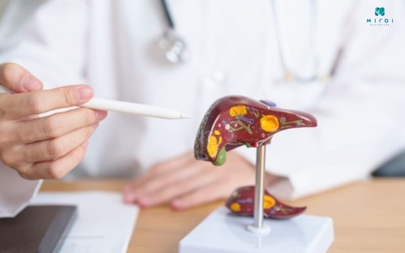 Xét nghiệm máu tổng quát giúp phát hiện tổn thương gan